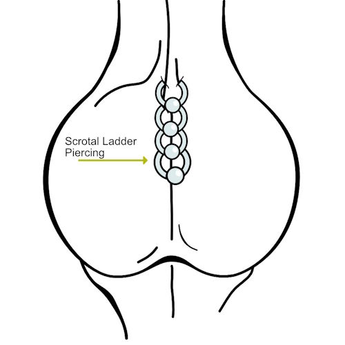 Hafada Ladder und Scrotal Ladder